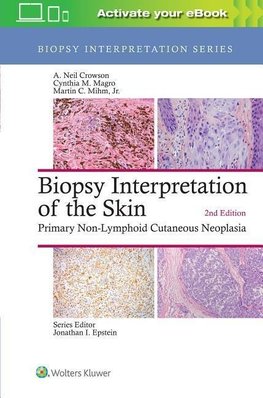 Biopsy Interpretation of the Skin (Biopsy Interpretation Series)