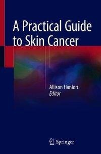 A Practical Guide to Skin Cancer