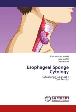 Esophageal Sponge Cytology