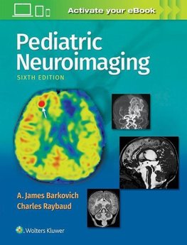 Pediatric Neuroimaging