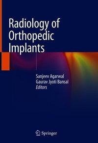 Radiology of Orthopedic Implants