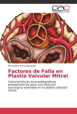 Factores de Falla en Plastia Valvular Mitral