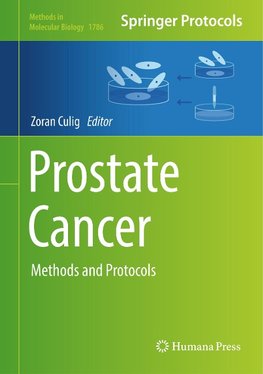 Prostate Cancer