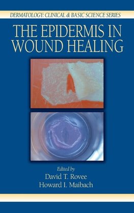 The Epidermis in Wound Healing