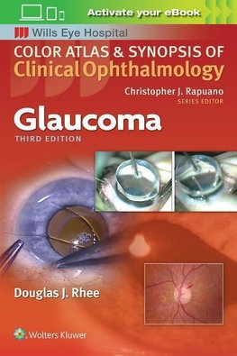 Glaucoma (Color Atlas and Synopsis of Clinical Ophthalmology)