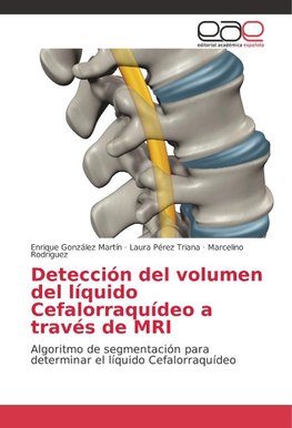 Detección del volumen del líquido Cefalorraquídeo a través de MRI