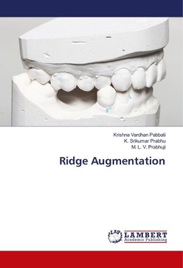 Ridge Augmentation