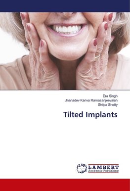 Tilted Implants