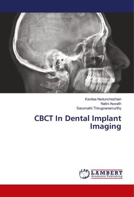 CBCT In Dental Implant Imaging