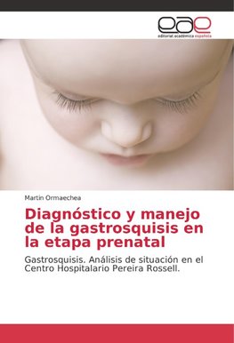 Diagnóstico y manejo de la gastrosquisis en la etapa prenatal