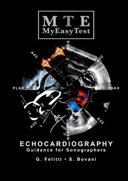 Echocardiography - MyEasyTest