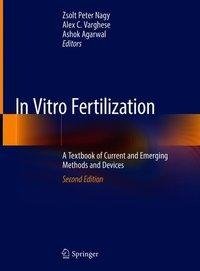 In Vitro Fertilization