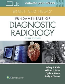 Brant and Helms' Fundamentals of Diagnostic Radiology