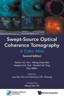 Swept-Source Optical Coherence Tomography