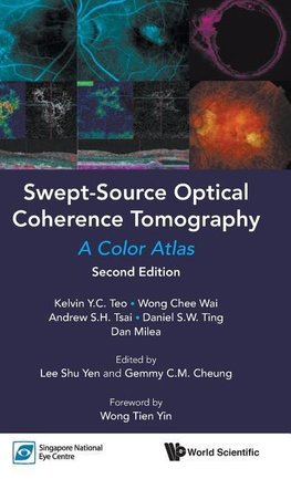 Swept-Source Optical Coherence Tomography