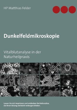 Dunkelfeldmikroskopie