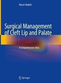 Surgical Management of Cleft Lip and Palate