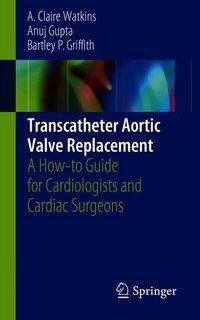 Transcatheter Aortic Valve Replacement