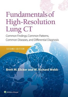 Fundamentals of High-Resolution Lung CT