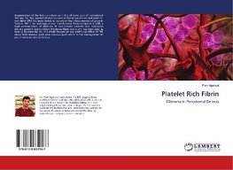 Platelet Rich Fibrin