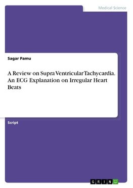 A Review on Supra Ventricular Tachycardia. An ECG Explanation on Irregular Heart Beats