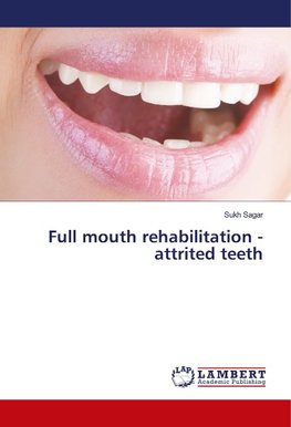 Full mouth rehabilitation - attrited teeth