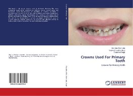 Crowns Used For Primary Teeth