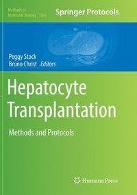 Hepatocyte Transplantation