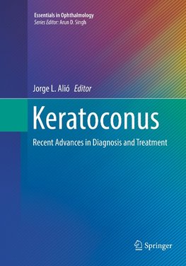 Keratoconus