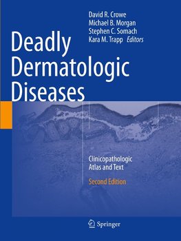 Deadly Dermatologic Diseases