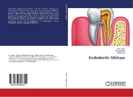 Endodontic Mishaps