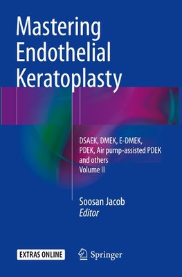 Mastering Endothelial Keratoplasty