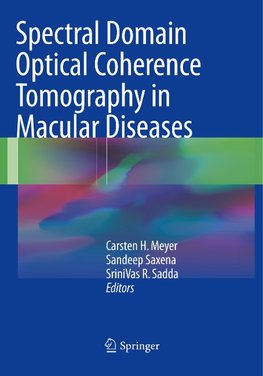 Spectral Domain Optical Coherence Tomography in Macular Diseases