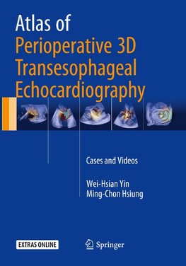 Atlas of Perioperative 3D Transesophageal Echocardiography