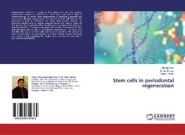 Stem cells in periodontal regeneration