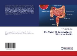 The Value Of Doxycycline In Ulcerative Colitis