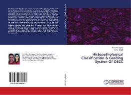 Histopathological Classification & Grading System Of OSCC