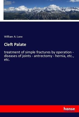 Cleft Palate