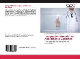 Imagen Multimodal en Amiloidosis Cardíaca