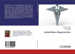 Guided Bone Regeneration