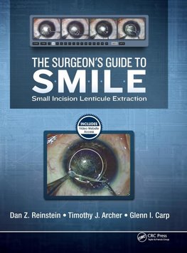 Reinstein, D:  The Surgeon's Guide to SMILE