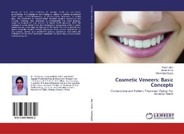 Cosmetic Veneers: Basic Concepts