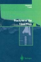 Fractures of the Tibial Pilon