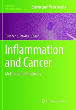 Inflammation and Cancer