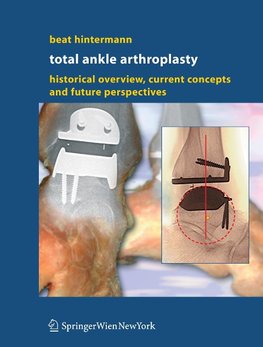 Total Ankle Arthroplasty