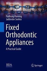 Fixed Orthodontic Appliances