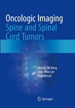 Oncologic Imaging: Spine and Spinal Cord Tumors