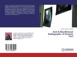 Oral & Maxillofacial Radiographs: A Forensic Tool