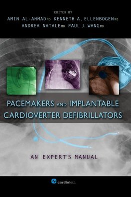 Pacemakers and Implantable Cardioverter Defibrillators