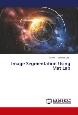 Image Segmentation Using Mat Lab